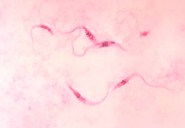 Las chinches de la cama pueden transmitir el parásito de la enfermedad de Chagas